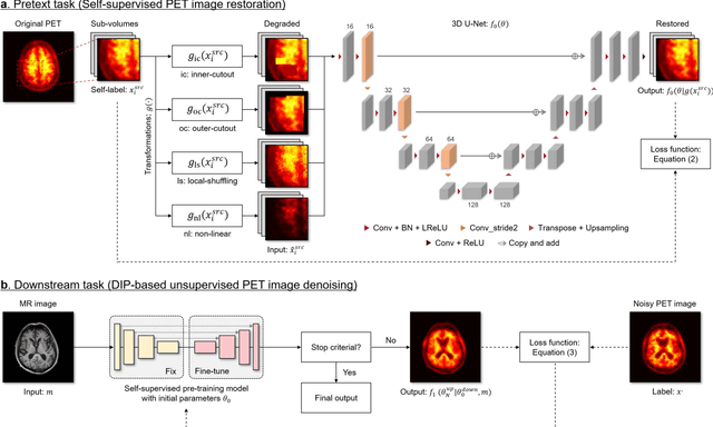 Figure 1 for Self-Supervised Pre-Training for Deep Image Prior-Based Robust PET Image Denoising