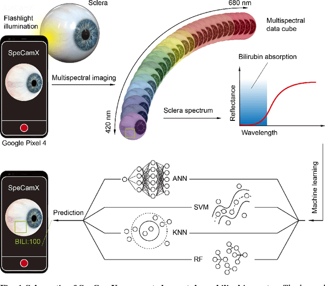 Figure 1 for Augmented smartphone bilirubinometer enabled by a mobile app that turns smartphone into multispectral imager