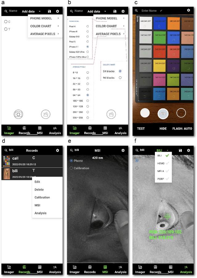 Figure 2 for Augmented smartphone bilirubinometer enabled by a mobile app that turns smartphone into multispectral imager