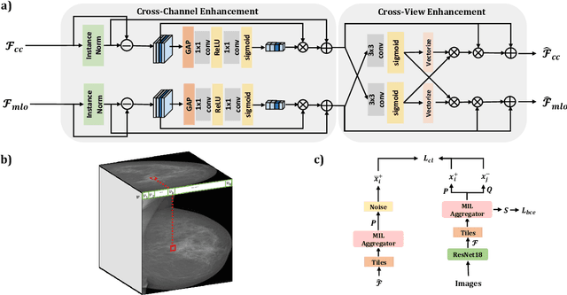 Figure 3 for MammoDG: Generalisable Deep Learning Breaks the Limits of Cross-Domain Multi-Center Breast Cancer Screening