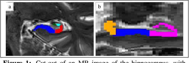 Figure 1 for An automated, geometry-based method for the analysis of hippocampal thickness