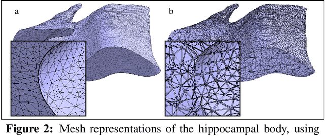 Figure 3 for An automated, geometry-based method for the analysis of hippocampal thickness