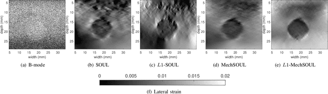 Figure 4 for Exploiting Mechanics-Based Priors for Lateral Displacement Estimation in Ultrasound Elastography