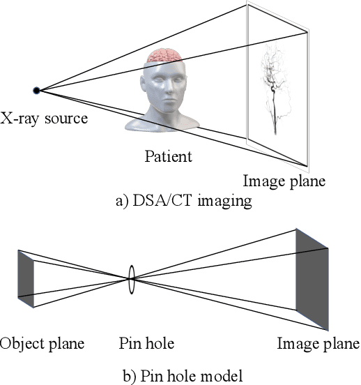 Figure 3 for TiAVox: Time-aware Attenuation Voxels for Sparse-view 4D DSA Reconstruction