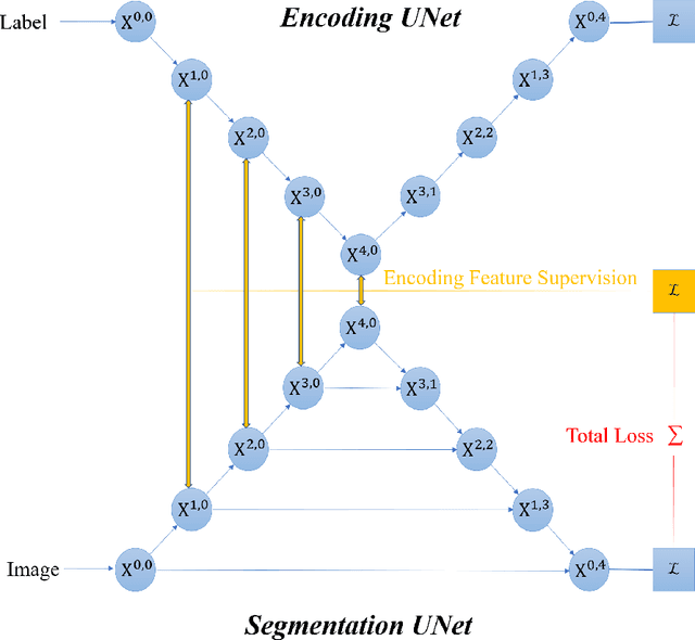 Figure 3 for Encoding feature supervised UNet++: Redesigning Supervision for liver and tumor segmentation