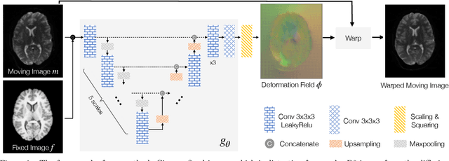 Figure 1 for DrDisco: Deep Registration for Distortion Correction of Diffusion MRI with single phase-encoding