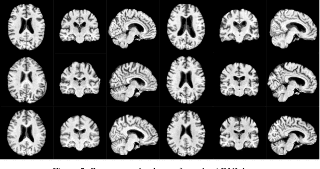 Figure 3 for Multiscale Metamorphic VAE for 3D Brain MRI Synthesis