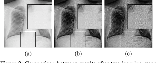 Figure 4 for Unsupervised Iterative U-Net with an Internal Guidance Layer for Vertebrae Contrast Enhancement in Chest X-Ray Images