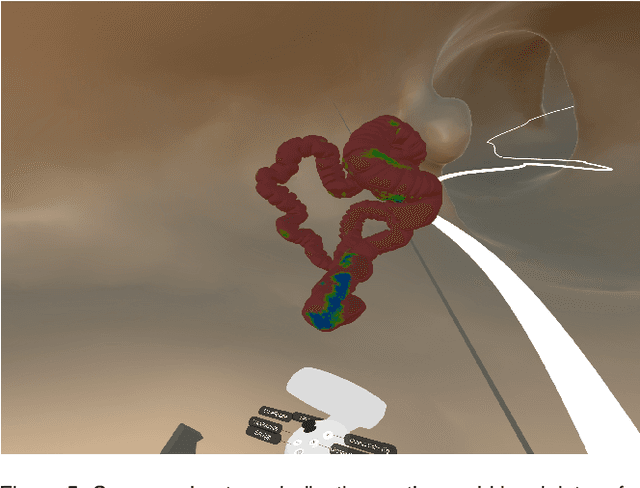 Figure 4 for Immersive Virtual Colonoscopy Viewer for Colorectal Diagnosis