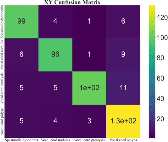 Figure 2 for A Voice Disease Detection Method Based on MFCCs and Shallow CNN