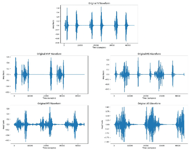 Figure 2 for Codec Data Augmentation for Time-domain Heart Sound Classification