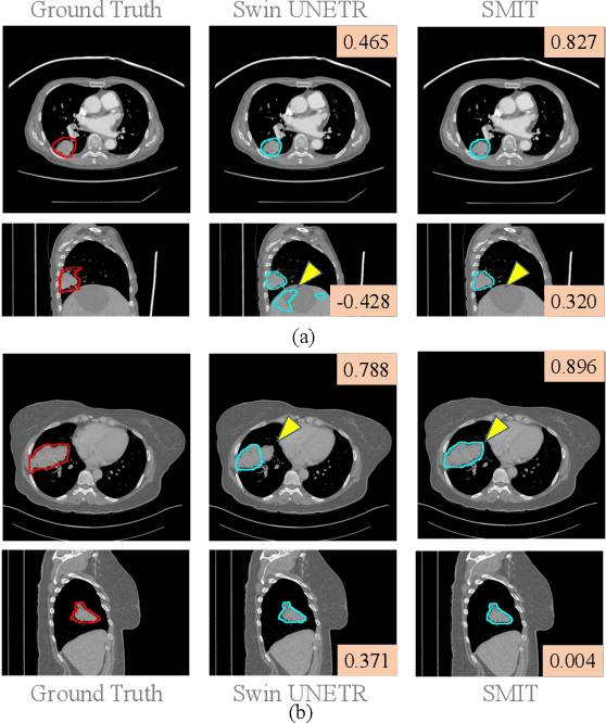 Figure 4 for Trustworthiness of Pretrained Transformers for Lung Cancer Segmentation