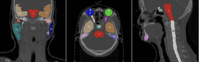 Figure 1 for Towards more precise automatic analysis: a comprehensive survey of deep learning-based multi-organ segmentation