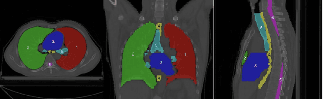 Figure 2 for Towards more precise automatic analysis: a comprehensive survey of deep learning-based multi-organ segmentation