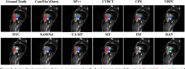 Figure 3 for Compete to Win: Enhancing Pseudo Labels for Barely-supervised Medical Image Segmentation