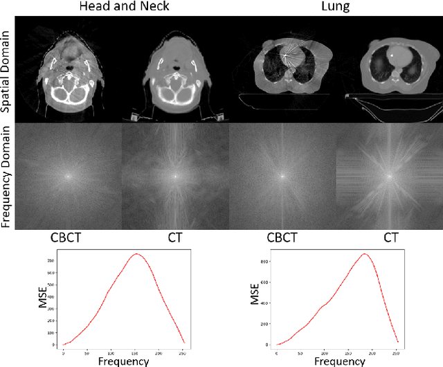 Figure 1 for Zero-shot Medical Image Translation via Frequency-Guided Diffusion Models