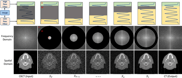 Figure 2 for Zero-shot Medical Image Translation via Frequency-Guided Diffusion Models