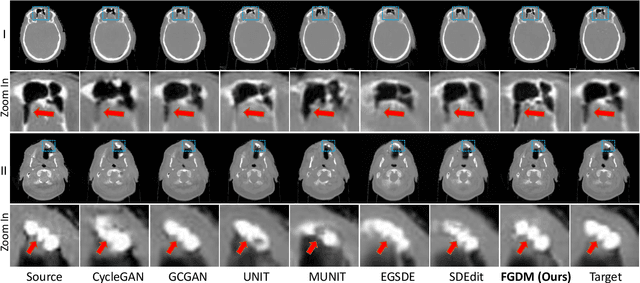 Figure 3 for Zero-shot Medical Image Translation via Frequency-Guided Diffusion Models