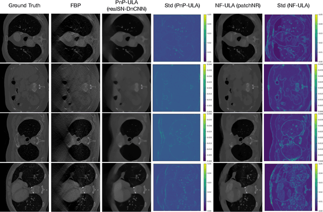 Figure 3 for NF-ULA: Langevin Monte Carlo with Normalizing Flow Prior for Imaging Inverse Problems