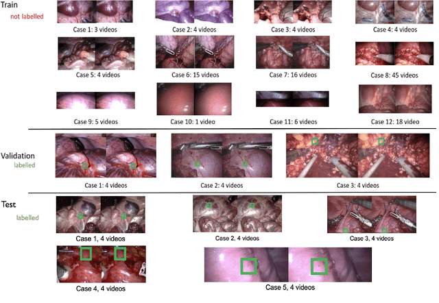Figure 2 for SurgT: Soft-Tissue Tracking for Robotic Surgery, Benchmark and Challenge