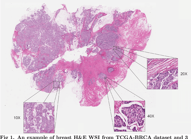 Figure 1 for Publicly available datasets of breast histopathology H&E whole-slide images: A systematic review