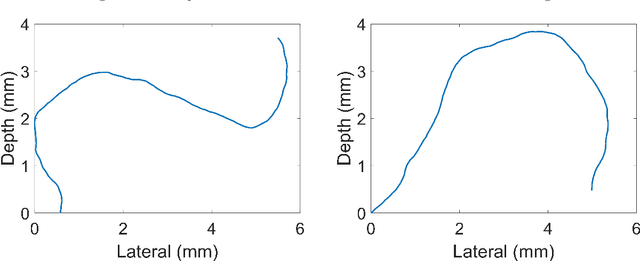 Figure 4 for Acceleration-Based Kalman Tracking for Super-Resolution Ultrasound Imaging in vivo