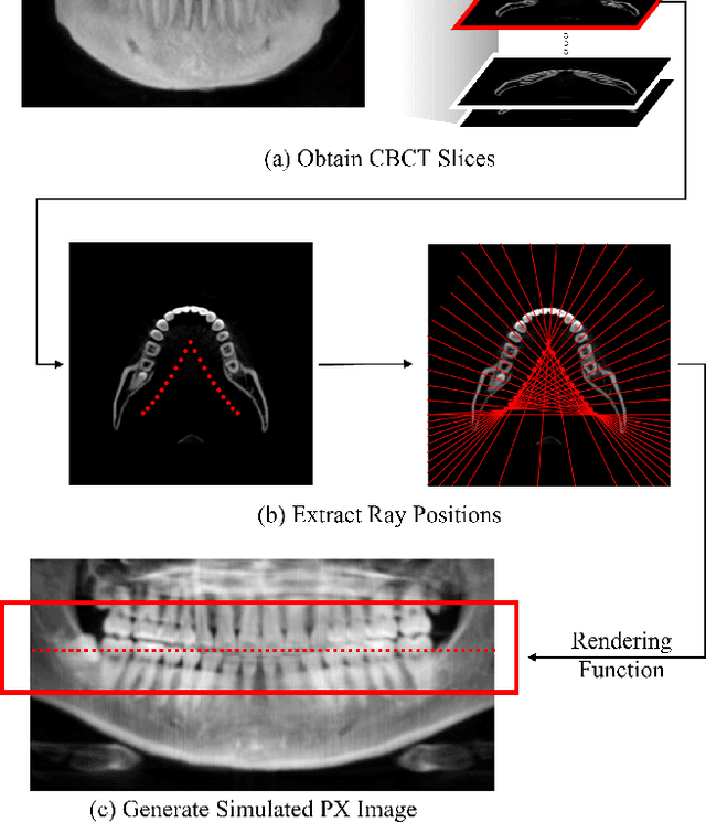 Figure 1 for NeBLa: Neural Beer-Lambert for 3D Reconstruction of Oral Structures from Panoramic Radiographs