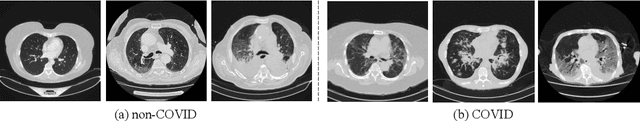 Figure 1 for CMC v2: Towards More Accurate COVID-19 Detection with Discriminative Video Priors