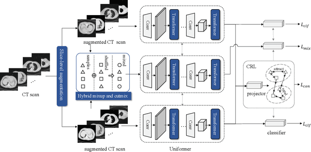 Figure 3 for CMC v2: Towards More Accurate COVID-19 Detection with Discriminative Video Priors