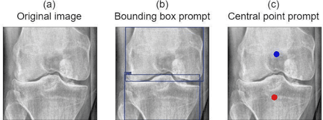 Figure 1 for Segmentation of Knee Bones for Osteoarthritis Assessment: A Comparative Analysis of Supervised, Few-Shot, and Zero-Shot Learning Approaches