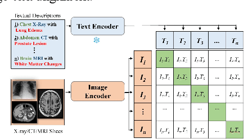 Figure 1 for RadCLIP: Enhancing Radiologic Image Analysis through Contrastive Language-Image Pre-training