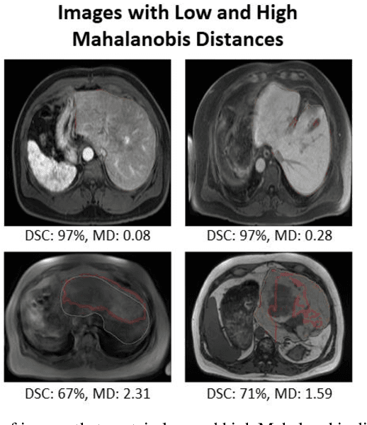 Figure 3 for Dimensionality Reduction for Improving Out-of-Distribution Detection in Medical Image Segmentation