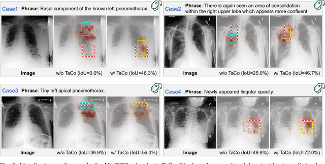 Figure 3 for Medical Phrase Grounding with Region-Phrase Context Contrastive Alignment