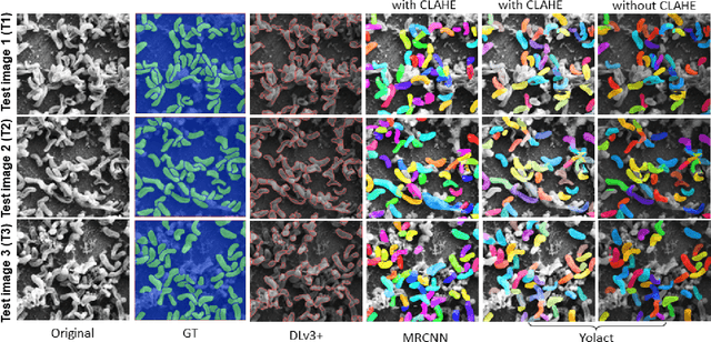 Figure 3 for BiofilmScanner: A Computational Intelligence Approach to Obtain Bacterial Cell Morphological Attributes from Biofilm Image