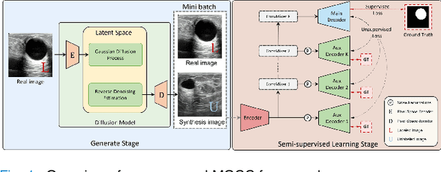 Figure 1 for Multi-Level Global Context Cross Consistency Model for Semi-Supervised Ultrasound Image Segmentation with Diffusion Model