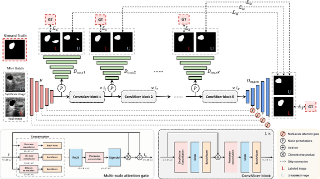 Figure 2 for Multi-Level Global Context Cross Consistency Model for Semi-Supervised Ultrasound Image Segmentation with Diffusion Model