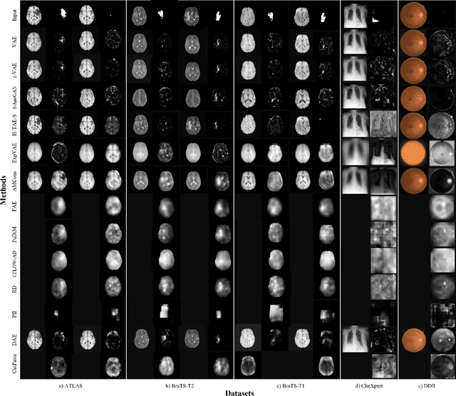 Figure 3 for Unsupervised Pathology Detection: A Deep Dive Into the State of the Art