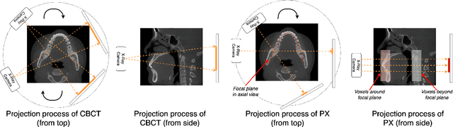 Figure 1 for Oral-NeXF: 3D Oral Reconstruction with Neural X-ray Field from Panoramic Imaging