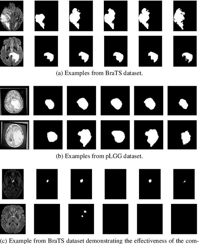 Figure 4 for A novel GAN-based paradigm for weakly supervised brain tumor segmentation of MR images