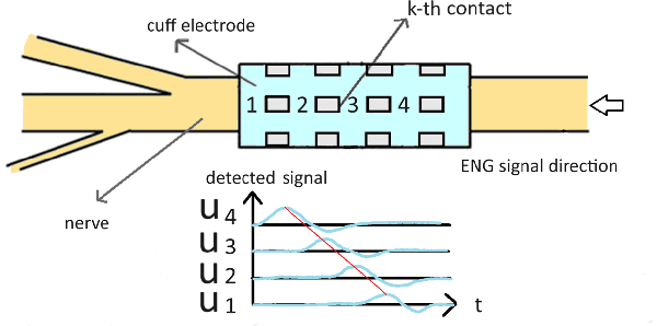 Figure 3 for Artificial Neural Networks-based Real-time Classification of ENG Signals for Implanted Nerve Interfaces