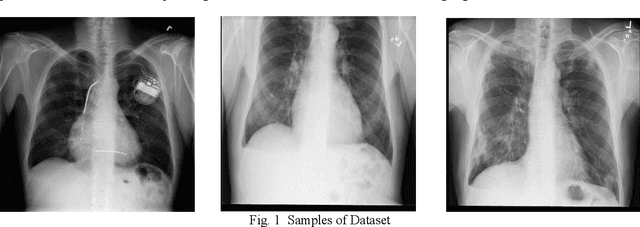 Figure 1 for Leveraging object detection for the identification of lung cancer
