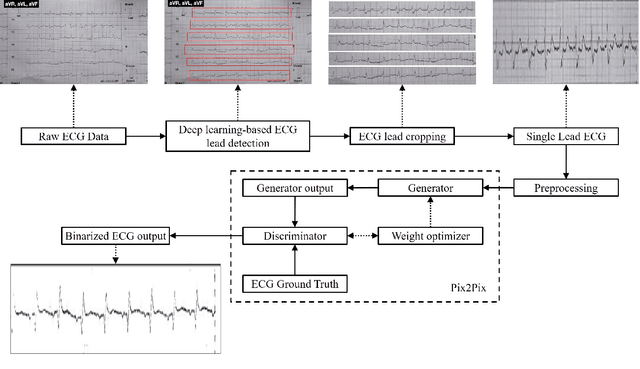 Figure 1 for Auto Lead Extraction and Digitization of ECG Paper Records using cGAN