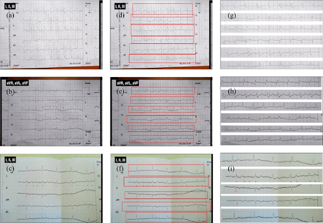 Figure 3 for Auto Lead Extraction and Digitization of ECG Paper Records using cGAN