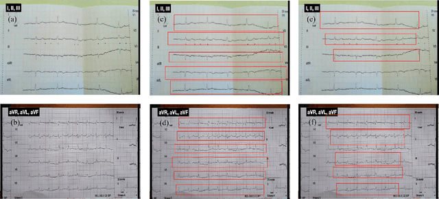 Figure 4 for Auto Lead Extraction and Digitization of ECG Paper Records using cGAN