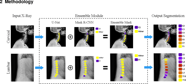 Figure 1 for VertXNet: An Ensemble Method for Vertebrae Segmentation and Identification of Spinal X-Ray