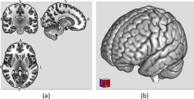 Figure 1 for Towards Practical Application of Deep Learning in Diagnosis of Alzheimer's Disease