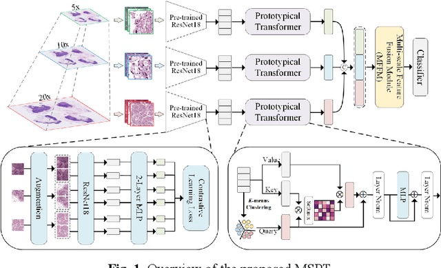 Figure 1 for Multi-Scale Prototypical Transformer for Whole Slide Image Classification