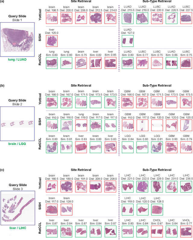 Figure 4 for Histopathology Slide Indexing and Search: Are We There Yet?