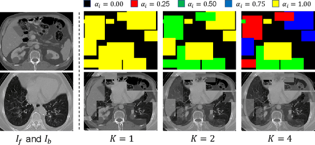 Figure 3 for MIS-FM: 3D Medical Image Segmentation using Foundation Models Pretrained on a Large-Scale Unannotated Dataset