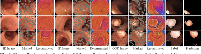 Figure 3 for Rethinking Polyp Segmentation from an Out-of-Distribution Perspective